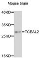 TCEAL2 Antibody - Western blot analysis of extracts of mouse brain, using TCEAL2 antibody at 1:3000 dilution. The secondary antibody used was an HRP Goat Anti-Rabbit IgG (H+L) at 1:10000 dilution. Lysates were loaded 25ug per lane and 3% nonfat dry milk in TBST was used for blocking. An ECL Kit was used for detection and the exposure time was 90s.