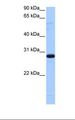 TCEANC2 Antibody - Fetal heart cell lysate. Antibody concentration: 0.5 ug/ml. Gel concentration: 12%.  This image was taken for the unconjugated form of this product. Other forms have not been tested.