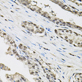 TCEB1 / Elongin C Antibody - Immunohistochemistry of paraffin-embedded human prostate.
