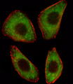 TCF25 Antibody - Fluorescent image of A549 cell stained with TCF25 Antibody. A549 cells were fixed with 4% PFA (20 min), permeabilized with Triton X-100 (0.1%, 10 min), then incubated with TCF25 primary antibody (1:25, 1 h at 37°C). For secondary antibody, Alexa Fluor 488 conjugated donkey anti-rabbit antibody (green) was used (1:400, 50 min at 37°C). Cytoplasmic actin was counterstained with Alexa Fluor 555 (red) conjugated Phalloidin (7units/ml, 1 h at 37°C). TCF25 immunoreactivity is localized to Cytoplasm significantly.