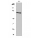 TCF3 / E2A Antibody - Western blot of TCF-3 antibody