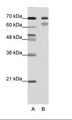 TCF3 / E2A Antibody - A: Marker, B: HepG2 Cell Lysate.  This image was taken for the unconjugated form of this product. Other forms have not been tested.