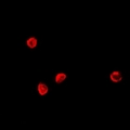 TCF4 Antibody - Immunofluorescent analysis of TCF4 staining in HeLa cells. Formalin-fixed cells were permeabilized with 0.1% Triton X-100 in TBS for 5-10 minutes and blocked with 3% BSA-PBS for 30 minutes at room temperature. Cells were probed with the primary antibody in 3% BSA-PBS and incubated overnight at 4 deg C in a humidified chamber. Cells were washed with PBST and incubated with a DyLight 594-conjugated secondary antibody (red) in PBS at room temperature in the dark.
