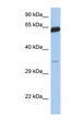 TCF7 Antibody - TCF7 antibody Western blot of Fetal Small Intestine lysate. This image was taken for the unconjugated form of this product. Other forms have not been tested.