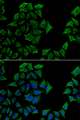 TCN1 Antibody - Immunofluorescence analysis of U2OS cells.