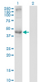 TCN2 Antibody - Western Blot analysis of TCN2 expression in transfected 293T cell line by TCN2 monoclonal antibody (M01), clone 2F4.Lane 1: TCN2 transfected lysate (Predicted MW: 47.5 KDa).Lane 2: Non-transfected lysate.
