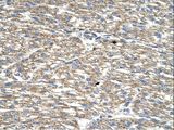 TCP10 Antibody - TCP10 antibody TCP10L(t-complex 10 (mouse)-like) Antibody was used in IHC to stain formalin-fixed, paraffin-embedded human heart.  This image was taken for the unconjugated form of this product. Other forms have not been tested.