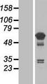 TCP11L1 Protein - Western validation with an anti-DDK antibody * L: Control HEK293 lysate R: Over-expression lysate