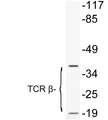 TCR Beta Antibody - Western blot analysis of lysate from COLO205 cells treated with Forskolin, using TCR Î² antibody.