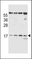 Antibody - TCRB Antibody western blot of MDA-MB231,293,Ramos,NCI-H460 cell line lysates (35 ug/lane). The TCRB antibody detected the TCRB protein (arrow).