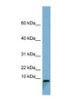 TCTA Antibody - TCTA antibody Western blot of Fetal Stomach lysate. This image was taken for the unconjugated form of this product. Other forms have not been tested.