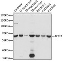 TCTE1 Antibody - Western blot analysis of extracts of various cell lines, using TCTE1 antibody at 1:1000 dilution. The secondary antibody used was an HRP Goat Anti-Rabbit IgG (H+L) at 1:10000 dilution. Lysates were loaded 25ug per lane and 3% nonfat dry milk in TBST was used for blocking. An ECL Kit was used for detection and the exposure time was 15s.