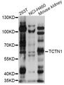 TCTN1 Antibody - Western blot analysis of extracts of various cell lines, using TCTN1 antibody at 1:1000 dilution. The secondary antibody used was an HRP Goat Anti-Rabbit IgG (H+L) at 1:10000 dilution. Lysates were loaded 25ug per lane and 3% nonfat dry milk in TBST was used for blocking. An ECL Kit was used for detection and the exposure time was 5s.