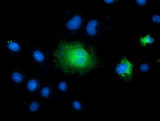 TCTN2 Antibody - Anti-TCTN2 mouse monoclonal antibody  immunofluorescent staining of COS7 cells transiently transfected by pCMV6-ENTRY TCTN2.