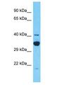 TDRD12 Antibody - TDRD12 antibody Western Blot of 721_B. Antibody dilution: 1 ug/ml.  This image was taken for the unconjugated form of this product. Other forms have not been tested.