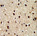 TECPR1 Antibody - Formalin-fixed and paraffin-embedded human brain reacted with TECPR1 Antibody , which was peroxidase-conjugated to the secondary antibody, followed by DAB staining. This data demonstrates the use of this antibody for immunohistochemistry; clinical relevance has not been evaluated.