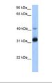 TECR / TER Antibody - 721_B cell lysate. Antibody concentration: 1.0 ug/ml. Gel concentration: 12%.  This image was taken for the unconjugated form of this product. Other forms have not been tested.