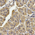 TECR / TER Antibody - Immunohistochemical analysis of TECR staining in human liver formalin fixed paraffin embedded tissue section. The section was pre-treated using heat mediated antigen retrieval with sodium citrate buffer (pH 6.0). The section was then incubated with the antibody at room temperature and detected using an HRP polymer system. DAB was used as the chromogen. The section was then counterstained with hematoxylin and mounted with DPX.