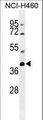 TECRL Antibody - SRD5A2L2 Antibody western blot of NCI-H460 cell line lysates (35 ug/lane). The SRD5A2L2 antibody detected the SRD5A2L2 protein (arrow).