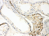 TECTA Antibody - IHC testing of FFPE human testis tissue with TECTA antibody at 1ug/ml. Required HIER: steam section in pH6 citrate buffer for 20 min and allow to cool prior to testing.
