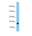 TEFM Antibody - Western blot of Human Fetal Brain. TEFM antibody dilution 1.0 ug/ml.  This image was taken for the unconjugated form of this product. Other forms have not been tested.