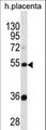 TEKT3 Antibody - TEKT3 Antibody western blot of human placenta tissue lysates (35 ug/lane). The TEKT3 antibody detected the TEKT3 protein (arrow).
