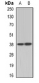 TEL-2 / ETV7 Antibody - Western blot analysis of TEL2 expression in A431 (A); HeLa (B) whole cell lysates.