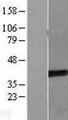 TEL-2 / ETV7 Protein - Western validation with an anti-DDK antibody * L: Control HEK293 lysate R: Over-expression lysate