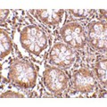 TEM1 / CD248 Antibody - Immunohistochemistry of TEM1 in human colon tissue with TEM1 antibody at 2.5 µg/mL.