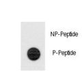 TERT / Telomerase Antibody - Dot blot of anti-Phospho-TERT-pS1125 Antibody on nitrocellulose membrane. 50ng of Phospho-peptide or Non Phospho-peptide per dot were adsorbed. Antibody working concentrations are 0.5ug per ml.