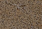 TEX10 Antibody - 1:100 staining mouse liver tissue by IHC-P. The sample was formaldehyde fixed and a heat mediated antigen retrieval step in citrate buffer was performed. The sample was then blocked and incubated with the antibody for 1.5 hours at 22°C. An HRP conjugated goat anti-rabbit antibody was used as the secondary.