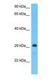 TEX101 Antibody - Western blot of TEX101 Antibody with human Jurkat Whole Cell lysate.  This image was taken for the unconjugated form of this product. Other forms have not been tested.