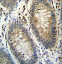 TEX261 Antibody - TEX261 Antibody immunohistochemistry of formalin-fixed and paraffin-embedded human colon tissue followed by peroxidase-conjugated secondary antibody and DAB staining.