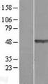 TEX28 Protein - Western validation with an anti-DDK antibody * L: Control HEK293 lysate R: Over-expression lysate