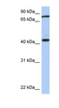 TEX9 Antibody - TEX9 antibody Western blot of Fetal Brain lysate. This image was taken for the unconjugated form of this product. Other forms have not been tested.