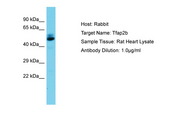 TFAP2B / AP2 Beta Antibody -  This image was taken for the unconjugated form of this product. Other forms have not been tested.