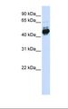 TFAP2B / AP2 Beta Antibody - Transfected 293T cell lysate. Antibody concentration: 1.0 ug/ml. Gel concentration: 12%.  This image was taken for the unconjugated form of this product. Other forms have not been tested.
