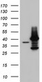 TFB1M Antibody - HEK293T cells were transfected with the pCMV6-ENTRY control (Left lane) or pCMV6-ENTRY TFB1M (Right lane) cDNA for 48 hrs and lysed. Equivalent amounts of cell lysates (5 ug per lane) were separated by SDS-PAGE and immunoblotted with anti-TFB1M.