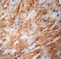 TFB2M Antibody - TFB2M Antibody immunohistochemistry of formalin-fixed and paraffin-embedded human heart carcinoma followed by peroxidase-conjugated secondary antibody and DAB staining.