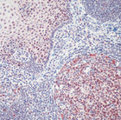 TFDP1 Antibody - Formalin-fixed, paraffin-embedded human tonsil stained with peroxidase-conjugate and AEC chromogen. Note nuclear and cytoplasmic staining of epithelial cells and lymphocytes.  This image was taken for the unmodified form of this product. Other forms have not been tested.