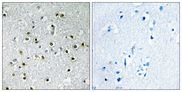 TFE3 Antibody - Immunohistochemistry analysis of paraffin-embedded human brain tissue, using TFE3 Antibody. The picture on the right is blocked with the synthesized peptide.