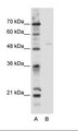 TFEB Antibody - A: Marker, B: HepG2 Cell Lysate.  This image was taken for the unconjugated form of this product. Other forms have not been tested.