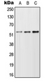 TFEB Antibody - Western blot analysis of TFEB expression in A549 (A); NIH3T3 (B); H9C2 (C) whole cell lysates.