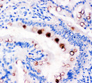 TFF1 / pS2 Antibody - TFF1 / PS2 antibody. IHC(P): Rat Intestine Tissue.