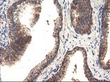 TFG Antibody - IHC of paraffin-embedded Human prostate tissue using anti-TFG mouse monoclonal antibody.