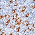 TG / Thyroglobulin Antibody - Formalin-fixed, paraffin-embedded human thyroid gland from Hashimoto's disease stained with peroxidase-conjugate and DAB chromogen. Note cytoplasmic staining of follicular cells.  This image was taken for the unmodified form of this product. Other forms have not been tested.