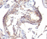 TGFA / TGF Alpha Antibody - IHC testing of FFPE human testicular carcinoma with TGF alpha antibody