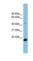 TGFB2 / TGF Beta2 Antibody - TGFB2 antibody Western blot of NCI-H226 cell lysate. This image was taken for the unconjugated form of this product. Other forms have not been tested.