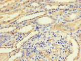 TGFB3 / TGF Beta3 Antibody - Immunohistochemistry of paraffin-embedded human kidney tissue using TGFB3 Antibody at dilution of 1:100
