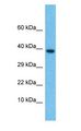 TGFB4 / LEFTY2 Antibody - TGFB4 / LEFTY2 antibody Western Blot of Thymus Tumor. Antibody dilution: 1 ug/ml.  This image was taken for the unconjugated form of this product. Other forms have not been tested.